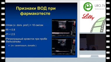 Курбатов Д.Г. - Вено-окклюзивная ЭД, современные возможности лечения