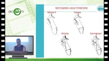 Абдулхамидов А.Н. - Реваскуляризация полового члена