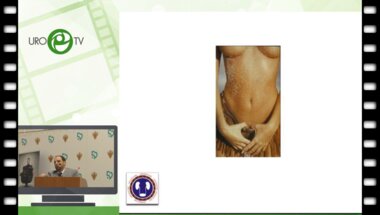 Оччархаджиев С. -  Реабилитация больных с показанием к замещению мочевого пузыря