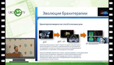 Цыбульский А.Д. - Возможности HDR брахитерапии в лечении рака простаты