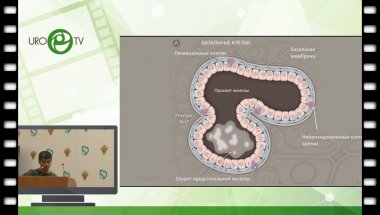 Беркут М.В. - Неоадьювантное лечение рака простаты