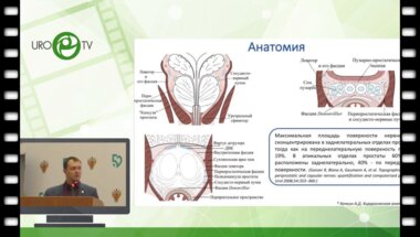 Вязовцев П.В. - Сравнительный анализ различных способов гемостаза при обработке сосудисто-нервных пучков в ходе нервосберегающей вне
