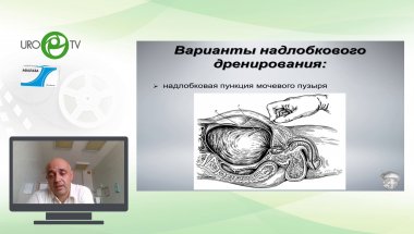 Шкодкин С.В. - Цистостома: установка, уход, прогноз