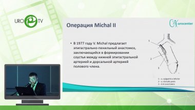 Мустафаев А.Т - Эволюция реваскуляризации ПЧ