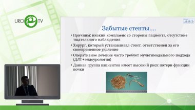 Обидняк В.М. - Забытые стенты современное решение проблемы