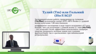 Цариченко Д.Г - Оптимизация параметров тулиевой литотрипсии в клинической практике