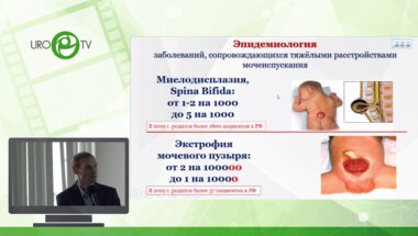 Сарычев С.А. - Операция Митрофанова у детей - инвестиция в будущее