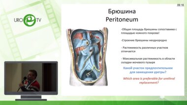 Григорьев В.Г. - Перитонеальный графт - первый опыт применения при аргументации протяженных стриктур уретры