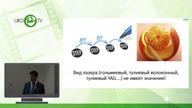 Дымов А.М. - Лазерная энуклеация step by step