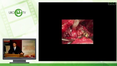 Григорьев Н.А. - Хирургия МКБ - прошлое, настоящее и будущее