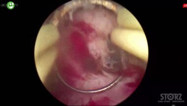 Зубков И.В. - П-ТУЭП (плазменная)