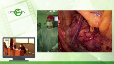 Новиков А.Б. - Лапароскопическая пластика ЛМС