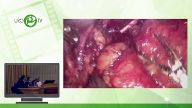 Операционная секция №2