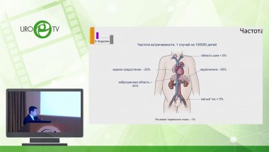 Ахаладзе Д.Г. - Сложности в детской онкохирургии