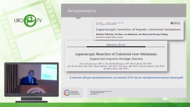 Ефанов М.Г. - Сравнительный анализ открытых и лапароскопических резекций печени при метастазах колоректального рака