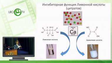 Просянников М.Ю. - Метафилактика мочекислого уролитиаза