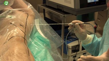 Мартов А.Г. - Микроперкутанная нефролитотрипсия