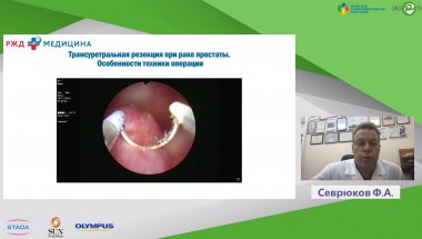Севрюков Ф.А. - Другие нюансы ТУР гиперплазии простаты глазами эксперта