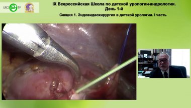 Зоркин С.Н. - Дренирование верхних мочевых путей при лапароскопических пластиках