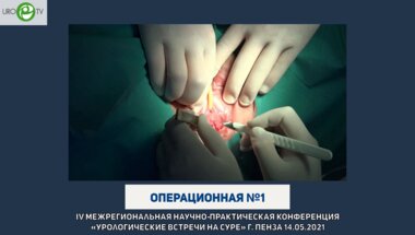 Фаниев М.В. - Установка нового субуретрального слинга при недержании мочи у женщин