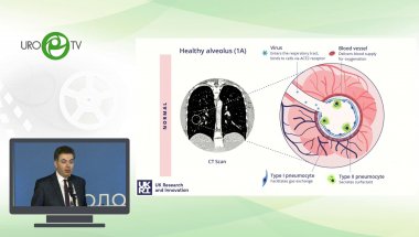 Мацкеплишвили С.Т. - Спорные вопросы протокола лечения SARS-СoV 2