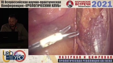 Холтобин Д.П. - Karl Storz Операция Лапароскопическая радикальная простатэктомия в формате 3D