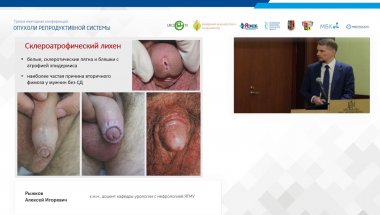 Рыжков А.И. - Предраковые заболевания полового члена