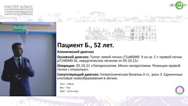 Шпоть Е.В - Робот-ассистированная ретроперитонеоскопическая резекции почки с опухолевым узлом REeNAL 10