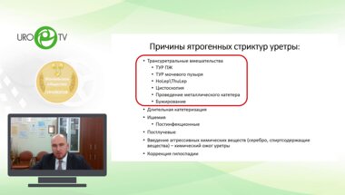 Котов С.В. - Ятрогенные стриктуры уретры после оперативного лечения ДГПЖ