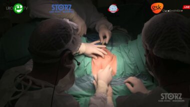 Филимонов В.Б., Васин Р.В. - Установка системы i-stop