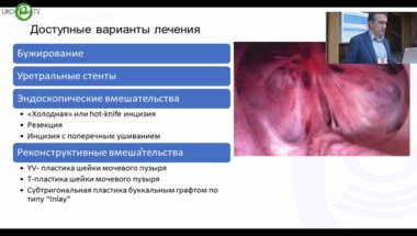 Орлов И.Н. - YV-пластика шейки мочевого пузыря при рецидивирующем стенозе