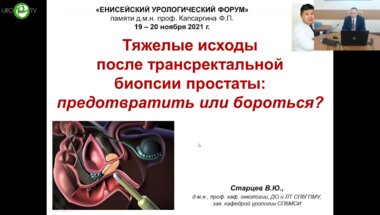 Старцев В.Ю. - Тяжёлые исходы после трансректальной биопсии простаты. Предотвратить или бороться