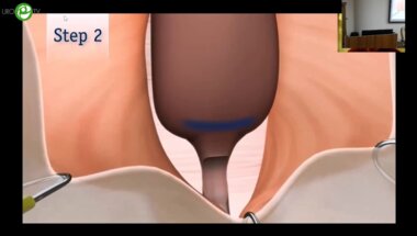 Котов С.В. - Мужской урослинг