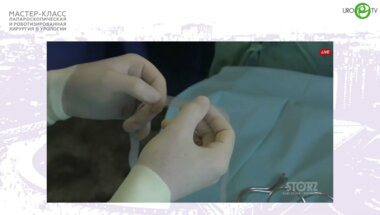 Филимонов В.Б. - TVT-O