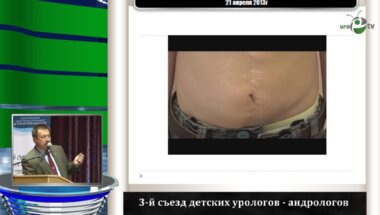 Павлов А.Ю. "Проблемы декретированного контингента детей с нарушениями мочеиспускания"