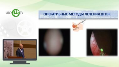 Камалов Д.М. - Трансперинеальная перкутанная лазерная абляция гиперплазии предстательной железы