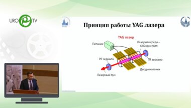 Сорокин Н.И. - Инновации в тулиево-волоконной хирургии