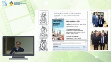 Казихинуров Р.А. - Dorsal free graft urethroplasty