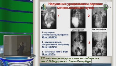 Сарычев С.А. "Хирургическое лечение нарушений резервуарной функции мочевого пузыря у детей с миелодисплазией"