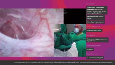 Операция 4. Фатихов Р.Р. - RIRS с использованием одноразового гибкого уретерореноскопа и тулиевого лазера