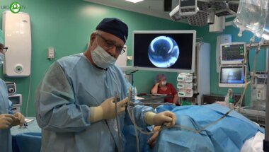 Горелов С.И. - Установка уретрального стента