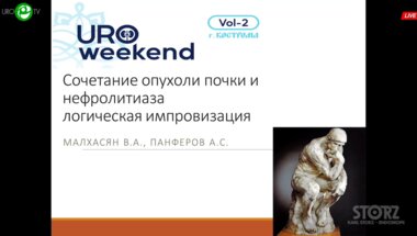 Панфёров А.С. - Сочетание опухоли почки и нефролитиаза. Логическая импровизация