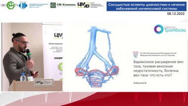 Лобастов К.В. - Варикозное расширение вен таза, тазовая венозная недостаточность, болезнь вен таза. Что есть что?