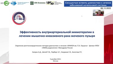 Рерберг А.Г. - Внутриартериальная химиотерапия при раке мочевого пузыря