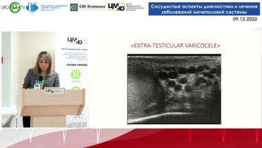 Чиликова А.А. - Критерии УЗ-диагностики варикоцеле и варикозного расширения вен таза