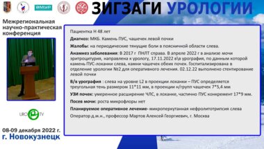 Операционная секция. Мартов А.Г. - Микроперкутанная нефролитотрипсия