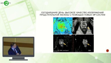 Синицын В.Е. - Современная роль методов лучевой диагностики в стадировании рака предстательной железы
