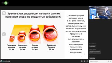 Зырянов А.В. - Гипогонадизм и коморбидные урологические заболевания – эректильная дисфункция, ДГПЖ, хронический рецидивирующий простатит