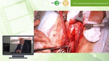 Даренков С.П. - Уретроуретроанастамоз