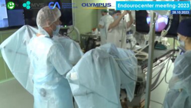 Севрюков Ф.А. - Трансуретральная энуклеация аденомы предстательной железы биполяром ТУЭБ